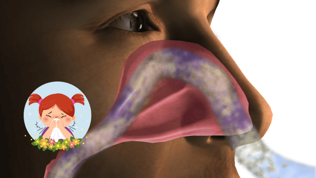 Effective Solutions for Nasal Allergies Prevention Tips